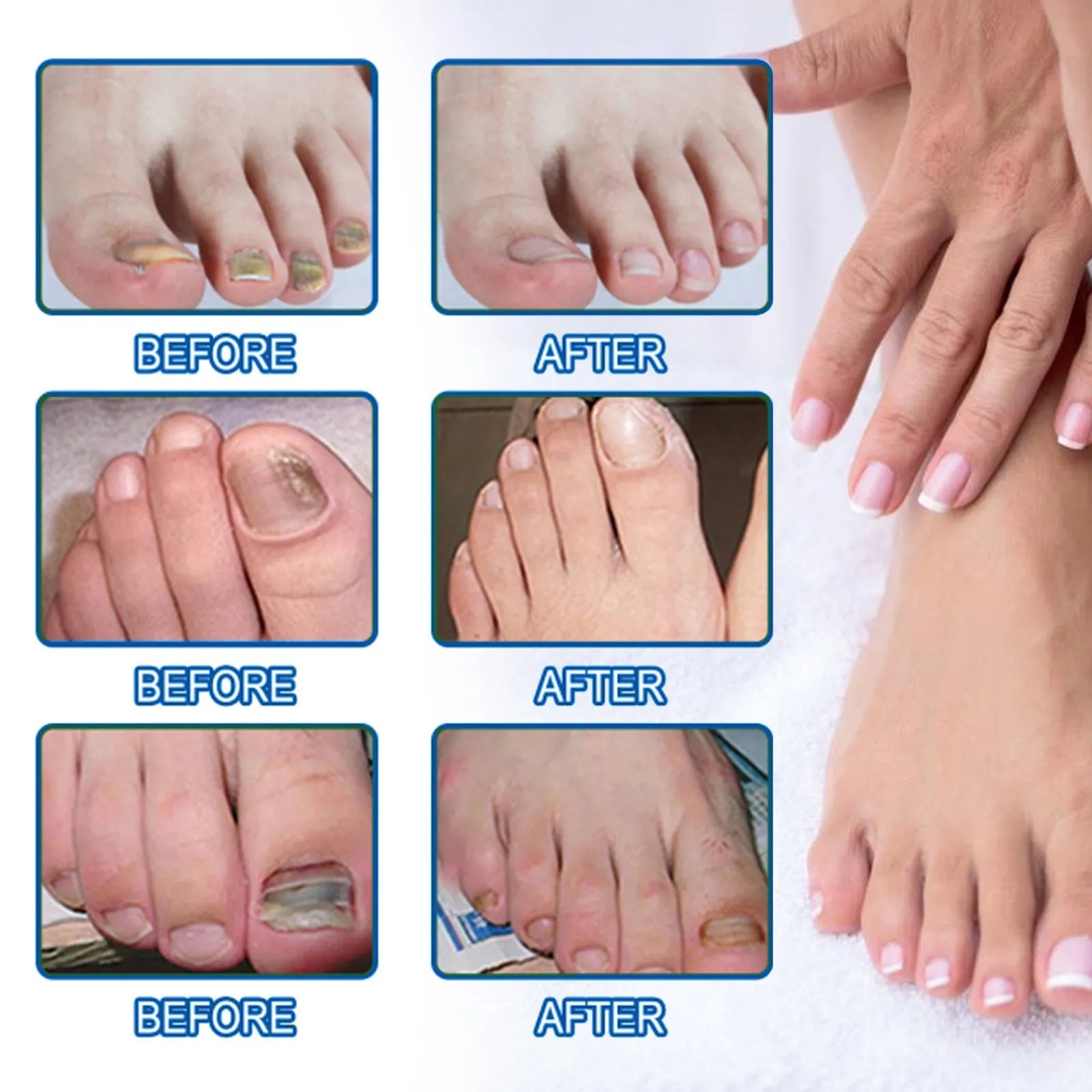 Box of 32 nail repair adhesive bandage patches measuring 6.1 by 3.5 centimetres each