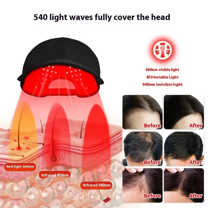 Black duckbill-style infrared hair growth cap with 180 red LEDs and a separate controller.