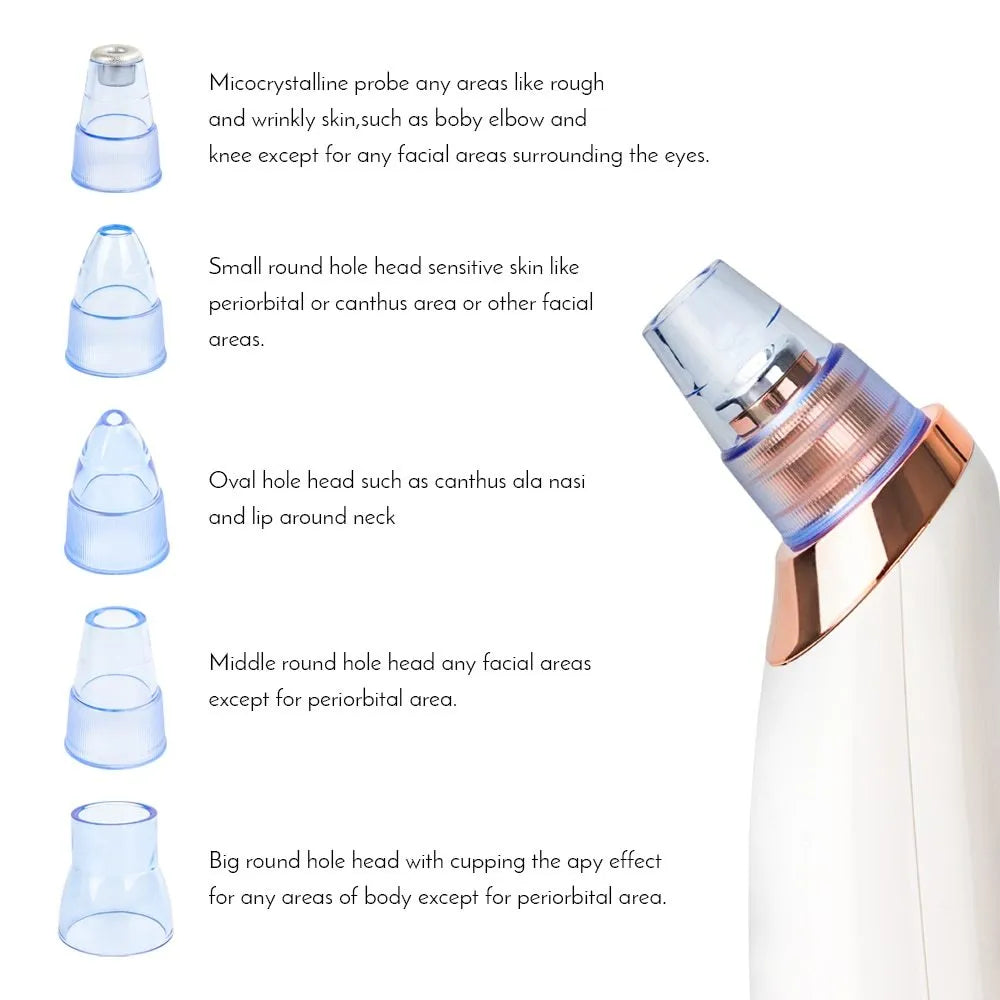 Electric blackhead removal device with multiple nozzle attachments for facial pore cleaning