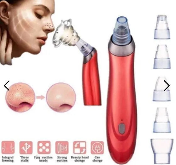 Electric blackhead removal device with multiple nozzle attachments for facial pore cleaning
