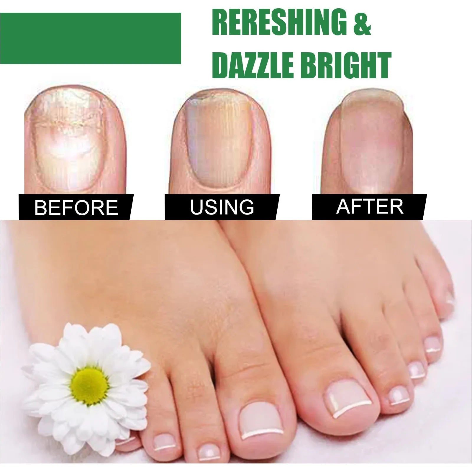 30ml bottle of tea tree oil nail care repair fluid for hand and foot treatment