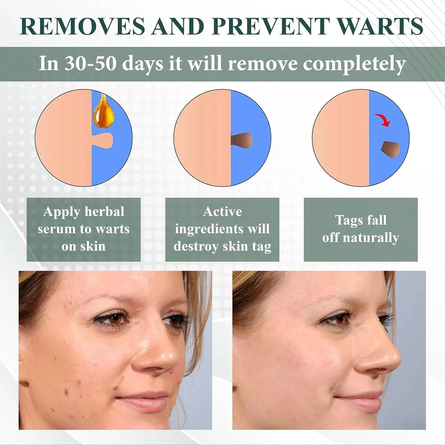 Natureerase Instant Mole Spot Removal Gel 45g tube for facial and body skincare treatment