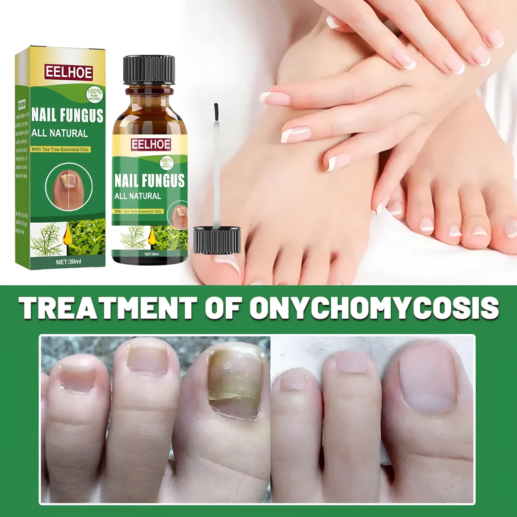 30ml bottle of tea tree oil nail care repair fluid for hand and foot treatment