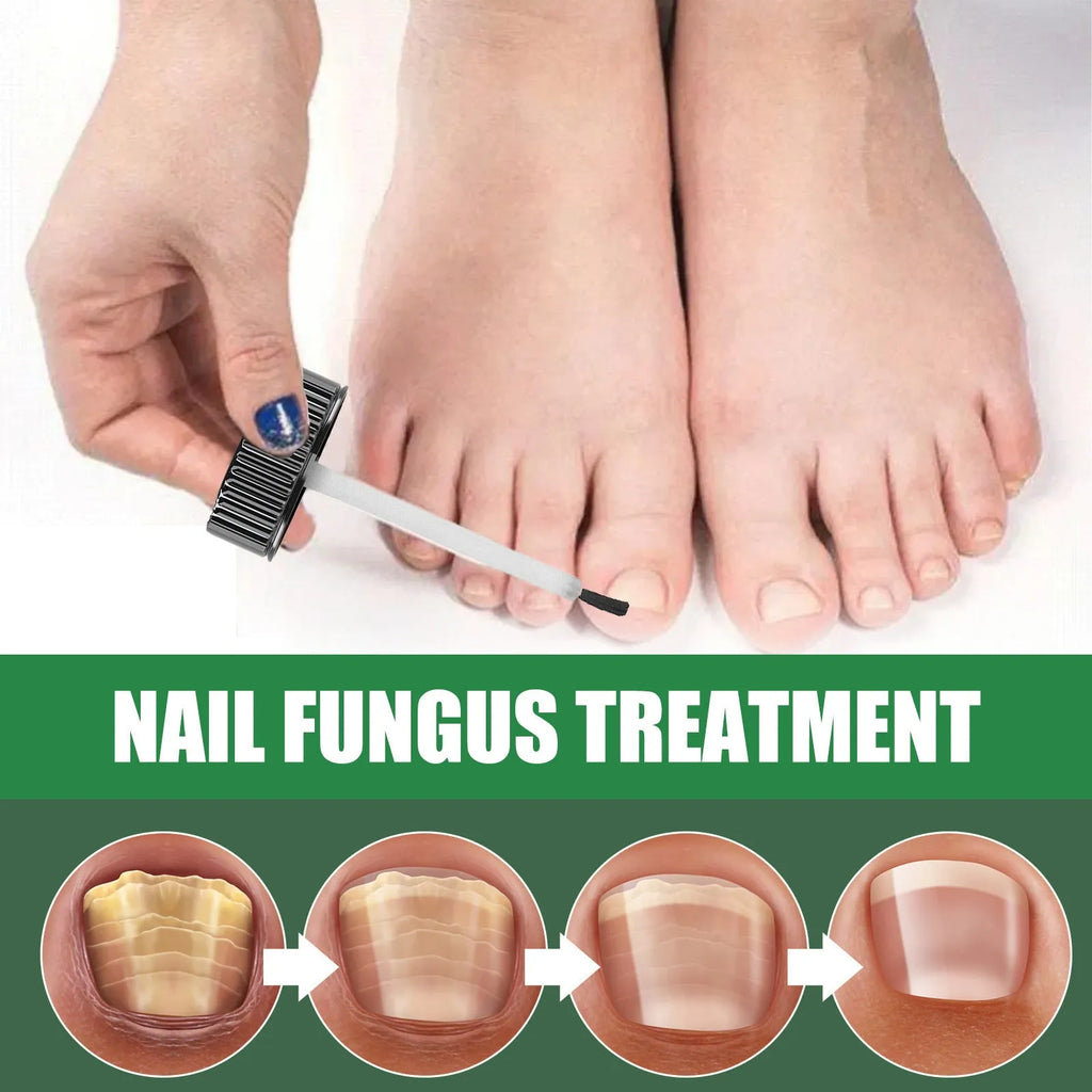 30ml bottle of tea tree oil nail care repair fluid for hand and foot treatment